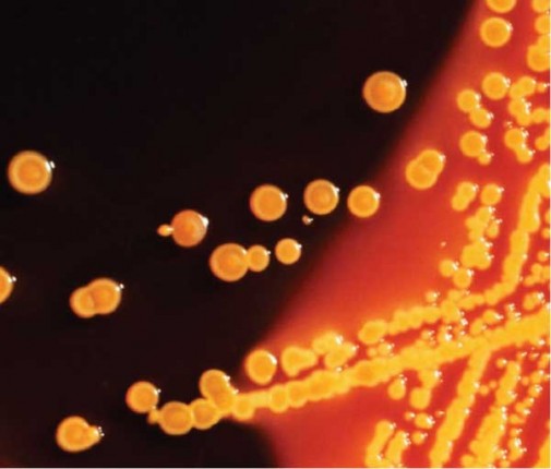 CDC warns against ‘lethal’ superbug