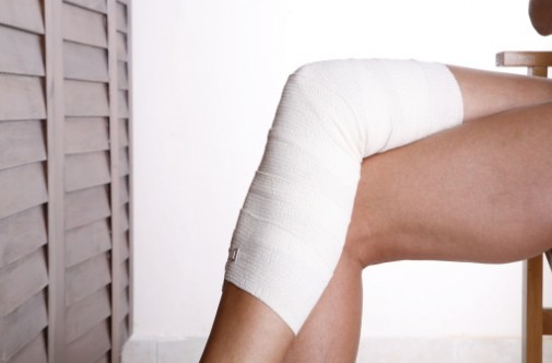 Living with varicose veins