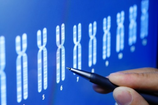 Link found between Down syndrome, Alzheimer’s