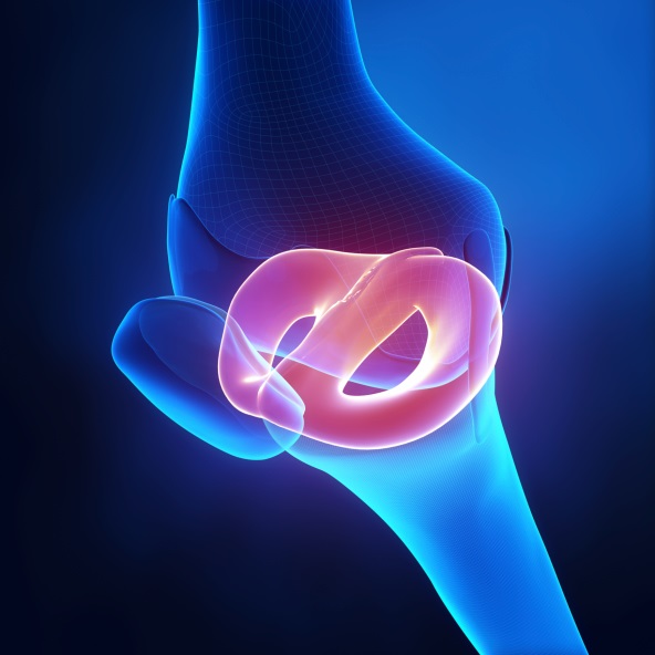 An expert’s take on Derrick Rose’s meniscus tear | health enews