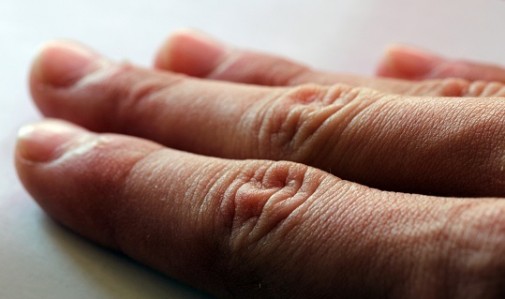 Is cracking your knuckles bad for you?