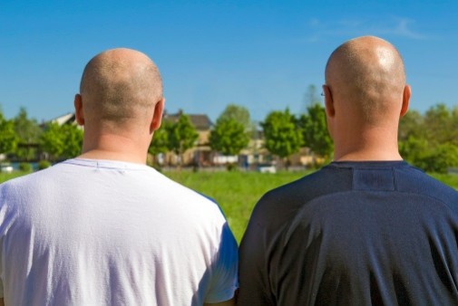 The truth about why men go bald