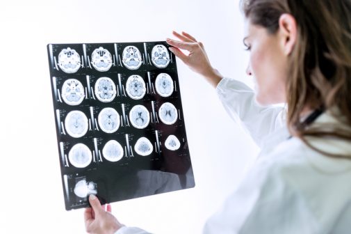 Is there a link between higher education and brain tumors?