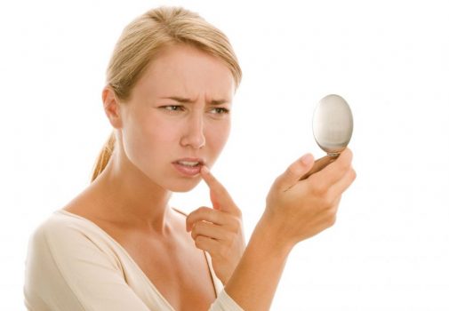5 ways to treat cold sores